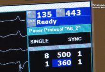 Na światowym poziomie