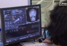 Start diagnostyki obrazowej w szpitalu